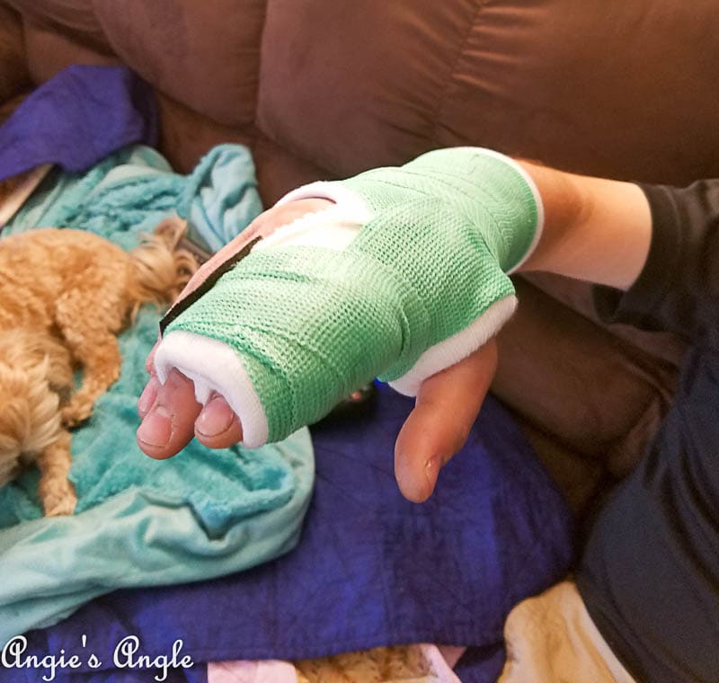 2017 Catch the Moment 365 Week 38 - Day 264 - Broken Hand Cast